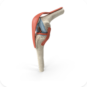 BONE DISORDERS